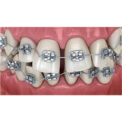 Orthodontics